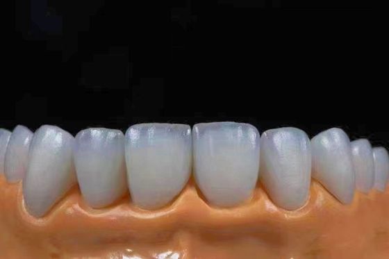 Купить Высокопрозрачные эстетические циркониевые короны, точно соответствующие естественному виду Производство в сети
