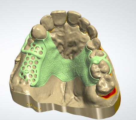 Купить Цифровая металлическая рамка CAD CAM Стоматологический дизайн Производство в сети