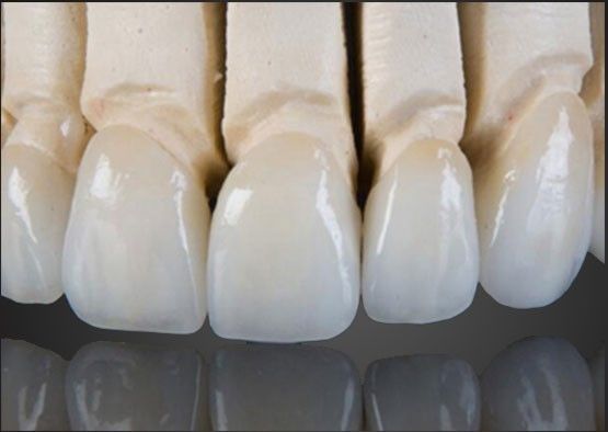 Wieland Zirconia Все керамические короны Внутренняя живопись на заказ с помощью CAD дизайна